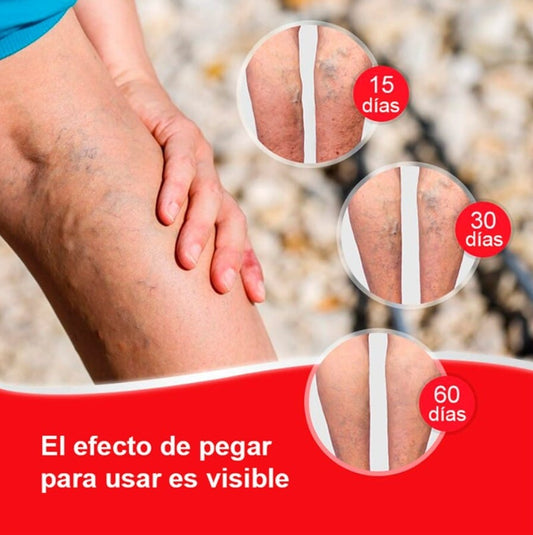 Super Oferta Pack 6 VarixEase™ ¿Cansada de piernas pesadas y várices visibles?